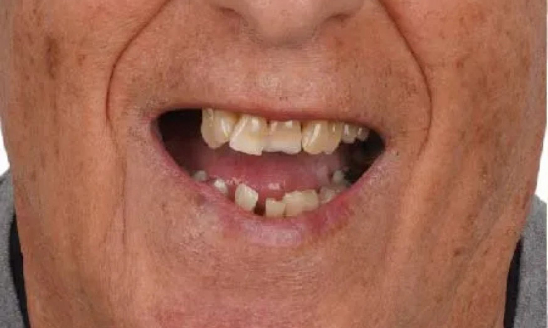 قبل 2